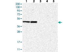 Western blot analysis of Lane 1: RT-4, Lane 2: U-251 MG, Lane 3: Human Plasma, Lane 4: Liver, Lane 5: Tonsil with BXDC5 polyclonal antibody . (RPF1 抗体)