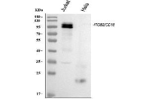 Western blot analysis of CD18/ITGB2 using anti-CD18/ITGB2 antibody (ABIN3043260). (Integrin beta 2 抗体  (AA 404-769))