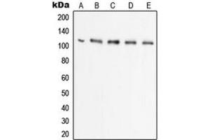 Western blot analysis of UBA7 expression in Raji (A), HL60 (B), HeLa (C), THP1 (D), A549 (E) whole cell lysates. (UBA7 抗体  (C-Term))