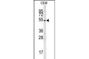 Western blot analysis of SMYD3 antibody (Center) (ABIN6242627 and ABIN6578989) in CEM cell line lysates (35 μg/lane). (SMYD3 抗体  (AA 209-236))