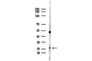 Western blot analysis of lysates from HUVEC cells(starvation,24h treatment), using ARB Antibody at 1/1000 dilution.