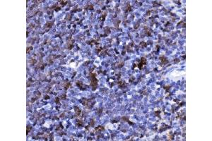 IHC analysis of CD20/MS4A1 using anti-CD20/MS4A1 antibody (ABIN7599223).
