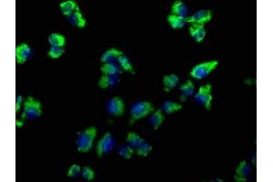 Immunofluorescence staining of Hela cells with ABIN7139819 at 1:66, counter-stained with DAPI.