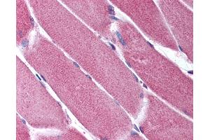 Anti-ORAI2 antibody IHC of human skeletal muscle. (ORAI2 抗体  (C-Term))