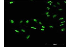 Immunofluorescence of purified MaxPab antibody to GTF2E1 on HeLa cell. (GTF2E1 抗体  (AA 1-439))