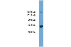 WB Suggested Anti-ZCCHC11 Antibody Titration: 0. (ZCCHC11 抗体  (Middle Region))