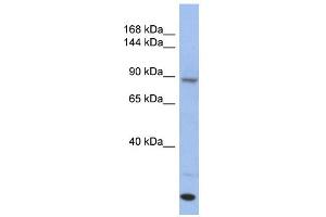 WB Suggested Anti-UNC45A Antibody Titration: 0.