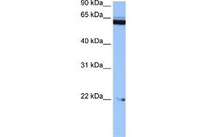 WB Suggested Anti-C14orf174 Antibody Titration: 0. (C14orf174 抗体  (N-Term))