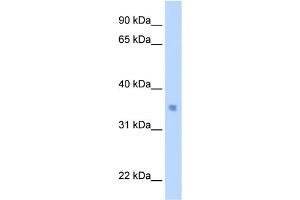 WB Suggested Anti-MLX Antibody Titration:  0.