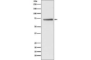 Western blot analysis of Cdc16/APC6 expression in HepG2 cell lysate. (Recombinant CDC16 抗体)