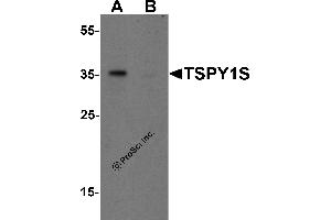 Western Blotting (WB) image for anti-TSPY1S (C-Term) antibody (ABIN1077409) (TSPY1S (C-Term) 抗体)