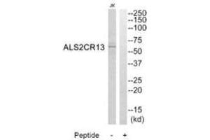 Western blot analysis of extracts from Jurkat cells, using ALS2CR13 antibody. (FAM117B 抗体  (C-Term))