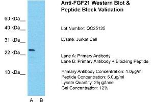 Host: Rabbit  Target Name: FGF21  Sample Tissue: Jurkat Whole Cell  Lane A:  Primary Antibody Lane B:  Primary Antibody + Blocking Peptide Primary Antibody Concentration: 1 µg/mL Peptide Concentration: 5 µg/mL Lysate Quantity: 41 µg/laneGel Concentration:. (FGF21 抗体  (N-Term))