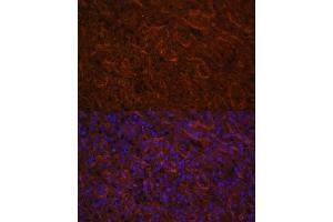 Immunofluorescence analysis of human spleen using ICOS/CD278 antibody (ABIN3022590, ABIN3022591, ABIN3022592, ABIN1513055 and ABIN6218929) at dilution of 1:100.