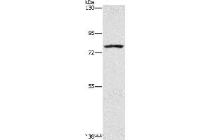 Western blot analysis of K562 cell, using SENP1 Polyclonal Antibody at dilution of 1:1500 (SENP1 抗体)