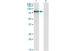 Western Blot analysis of RBM5 expression in transfected 293T cell line by RBM5 monoclonal antibody (M02), clone 3G6. (RBM5 抗体  (AA 75-184))