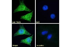 Immunofluorescence (IF) image for anti-Proteasome (Prosome, Macropain) 26S Subunit, Non-ATPase, 2 (PSMD2) (C-Term) antibody (ABIN185319)
