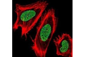 Fluorescent confocal image of HeLa cells stained with UHRF1 antibody. (UHRF1 抗体  (AA 229-257))
