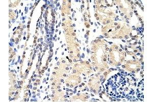 EXOSC3 antibody was used for immunohistochemistry at a concentration of 4-8 ug/ml to stain Epithelial cells of renal tubule (arrows) in Human Kidney. (EXOSC3 抗体  (C-Term))
