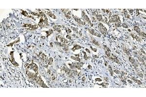 IHC analysis of DGKZ/DGK-zeta using anti-DGKZ/DGK-zeta antibody (ABIN7602261).