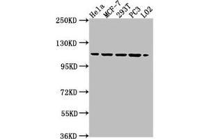Western Blot Positive WB detected in: HeLa whole cell lysate, MCF-7 whole cell lysate, 293T whole cell lysate, PC3 whole cell lysate, L02 whole cell lysate All lanes: CSE1L antibody at 1:2000 Secondary Goat polyclonal to rabbit IgG at 1/50000 dilution Predicted band size: 111, 23, 108, 104 kDa Observed band size: 111 kDa (Exportin 2 抗体  (AA 713-971))