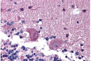 Human Brain, Cerebellum (formalin-fixed, paraffin-embedded) stained with KAL1 antibody ABIN214798 at 5 ug/ml followed by biotinylated goat anti-rabbit IgG secondary antibody ABIN481713, alkaline phosphatase-streptavidin and chromogen.