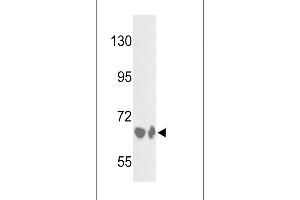 Western blot analysis of BF Antibody (Center) (ABIN391536 and ABIN2841487) in HepG2 cell line and mouse liver tissue lysates (35 μg/lane). (Complement Factor B 抗体  (Center))