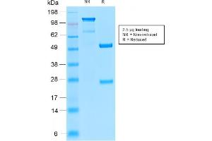 SDS-PAGE Analysis of Purified Insulin Receptor Rabbit Recombinant Monoclonal Antibody (INSR/2277R). (Recombinant Insulin Receptor 抗体  (Extracellular Domain))