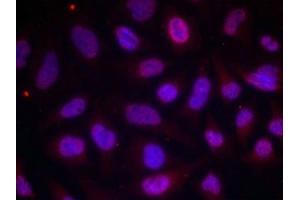 Immunofluorescence staining of methanol-fixed Hela cells using MEF2A(Phospho-Thr312) Antibody. (MEF2A 抗体  (pThr312))