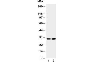 Western blot testing of Prion protein antibody and Lane 1:  rat brain;  2: rat brain. (PRNP 抗体  (Middle Region))