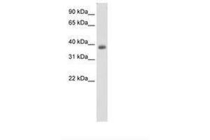Image no. 1 for anti-Neurogenic Differentiation 2 (NEUROD2) (C-Term) antibody (ABIN6736131) (NEUROD2 抗体  (C-Term))