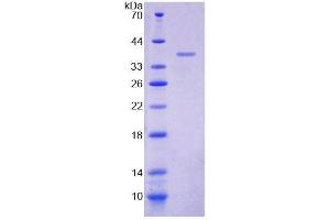 SDS-PAGE analysis of Human IL8Rb Protein. (CXCR2 蛋白)