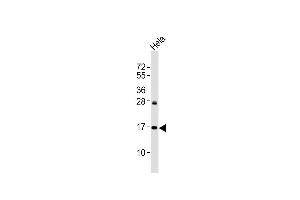 Western Blotting (WB) image for anti-Cyclin-Dependent Kinase Inhibitor 2A (Melanoma, P16, Inhibits CDK4) (CDKN2A) (AA 145-176), (Ser152) antibody (ABIN6243105)