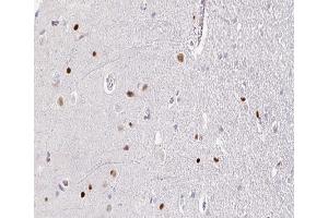 ABIN6266664 at 1/100 staining human brain tissue sections by IHC-P. (TOP2B 抗体  (N-Term))