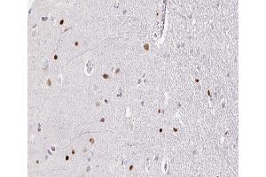 ABIN6266664 at 1/100 staining human brain tissue sections by IHC-P.