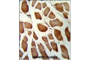 Immunohistochemistry (Paraffin-embedded Sections) (IHC (p)) image for anti-Glutathione S-Transferase omega 1 (GSTO1) (AA 126-155) antibody (ABIN389475)
