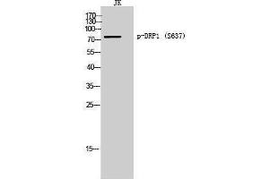 Western Blotting (WB) image for anti-Dynamin 1-Like (DNM1L) (pSer637) antibody (ABIN3173347) (Dynamin 1-Like 抗体  (pSer637))