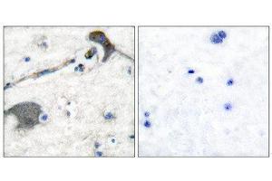 Immunohistochemistry (IHC) image for anti-RASH/RASK/RASN (N-Term) antibody (ABIN1848756) (RASH/RASK/RASN (N-Term) 抗体)