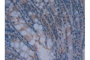 Detection of GKRP in Mouse Intestine Tissue using Polyclonal Antibody to Glucokinase Regulatory Protein (GKRP) (GCKR 抗体  (AA 17-261))