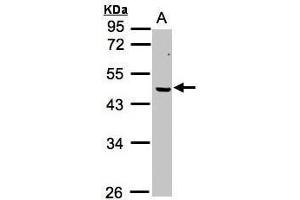 WB Image Sample (30μg whole cell lysate) A:MOLT4 , 10% SDS PAGE antibody diluted at 1:1000 (ERCC8 抗体  (Center))