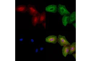 ABIN6260590 and ABIN6278435 staining  cells by IF/ICC.