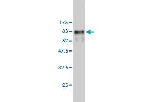 Western Blotting (WB) image for anti-T-Complex Protein 1 Subunit zeta-2-Like (CCT6B) (AA 1-530) antibody (ABIN564662)