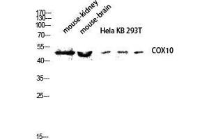 Western Blot (WB) analysis of Mouse Kidney Mouse Brain HeLa KB 293T lysis using COX10 antibody. (COX10 抗体  (Internal Region))