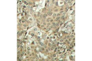 Immunohistochemistry (IHC) image for anti-Cofilin 1 (CFL1) (pSer3) antibody (ABIN3019729) (Cofilin 抗体  (pSer3))
