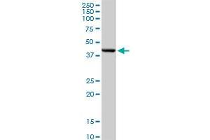 DNMT3L MaxPab rabbit polyclonal antibody. (DNMT3L 抗体  (AA 1-386))