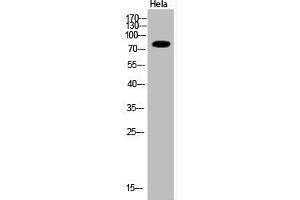 Western Blot analysis of Hela cells using Acetyl-Ub (K33) Polyclonal Antibody (UBA52/RPS27A/UBB/UBC (acLys33) 抗体)