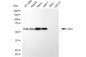 Western blotting analysis using GDI1 antibody (ABIN7798700).