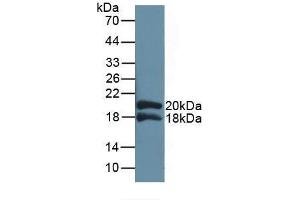 Detection of Recombinant IL1RAP, Human using Polyclonal Antibody to Interleukin 1 Receptor Accessory Protein (IL1RAP) (IL1RAP 抗体  (AA 420-558))