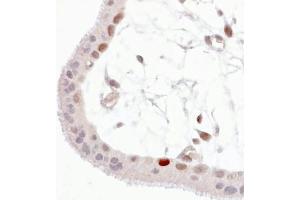 Immunohistochemistry staining of Wild-type p53 expressed in human trophoblast (paraffin-embedded sections). (p53 抗体  (pSer392))