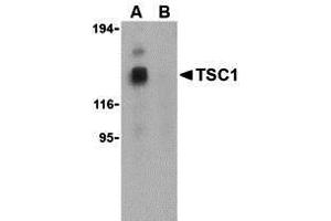Western Blotting (WB) image for anti-Tuberous Sclerosis 1 (TSC1) (Middle Region) antibody (ABIN1031146) (TSC1 抗体  (Middle Region))